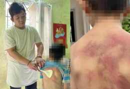 Cha bạo hành con ruột ở Đồng Nai: Dùng dây sạc, xẻng nấu ăn đánh con