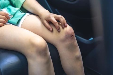 Một loại ung thư phổ biến đang gia tăng rất nhanh ca mắc