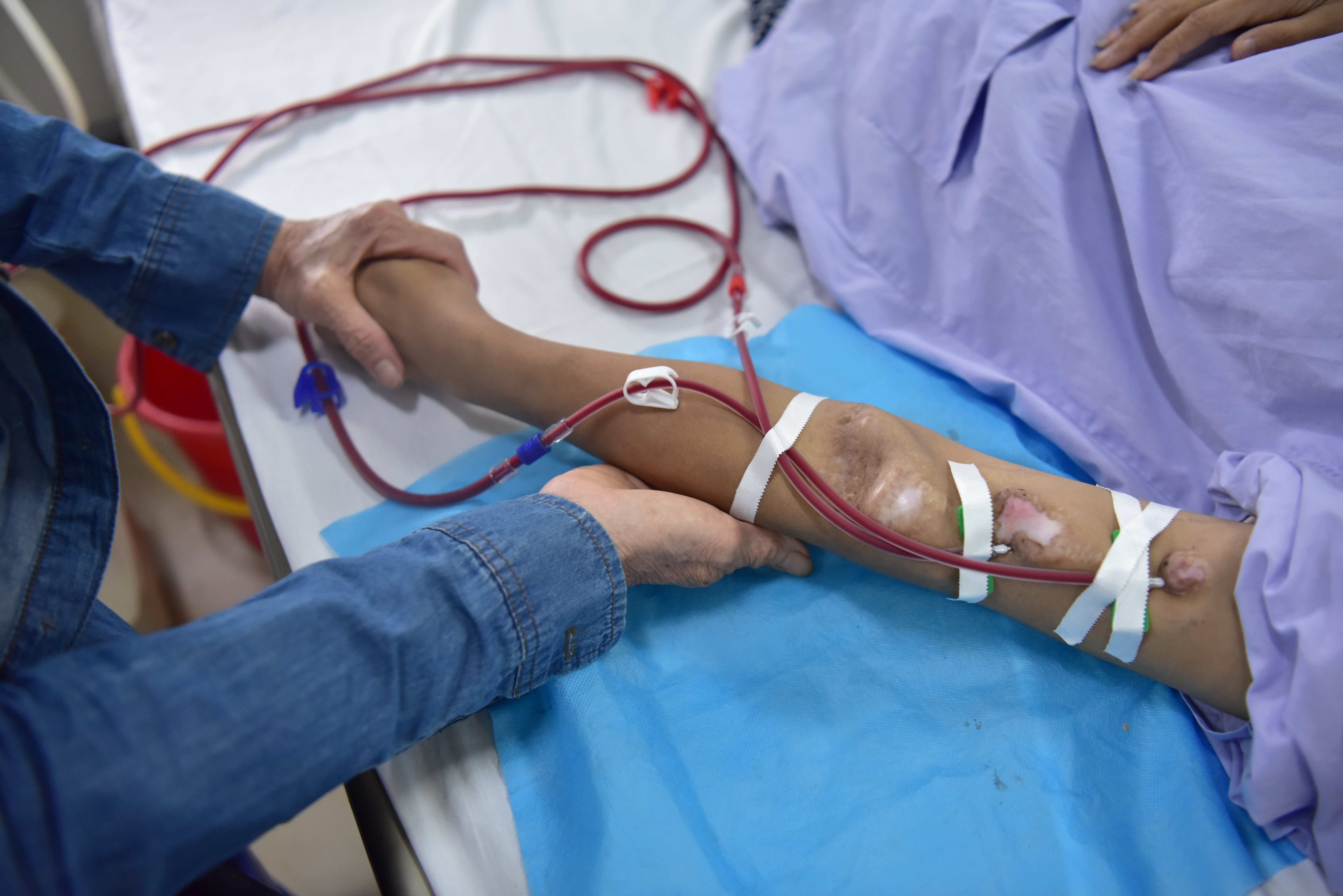 Thận đang 'kêu cứu' nhưng bạn không biết