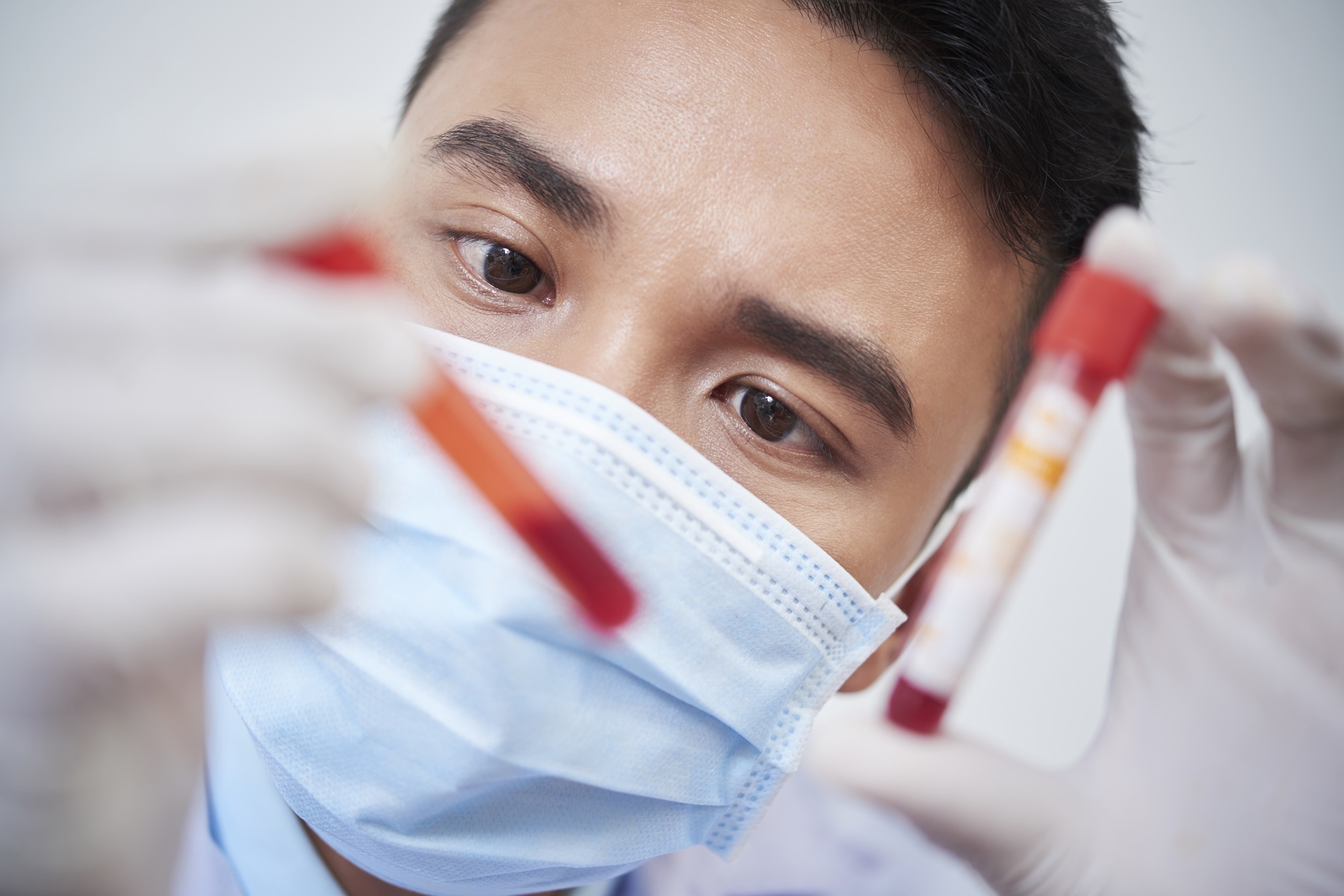 Vì sao ngày càng nhiều người trẻ Việt bị mỡ máu cao?
