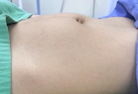 Bé gái 15 tuổi bất ngờ mắc loại ung thư sinh dục hiếm gặp
