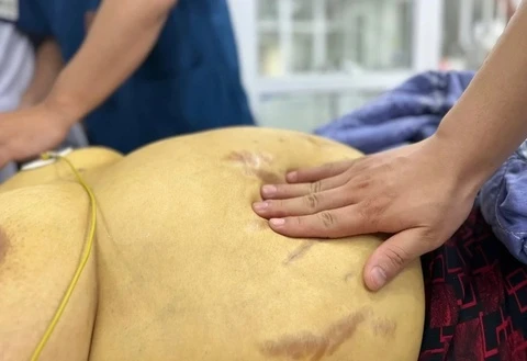 Một bệnh âm thầm hủy hoại gan, gieo rủi ro qua nhiều thế hệ