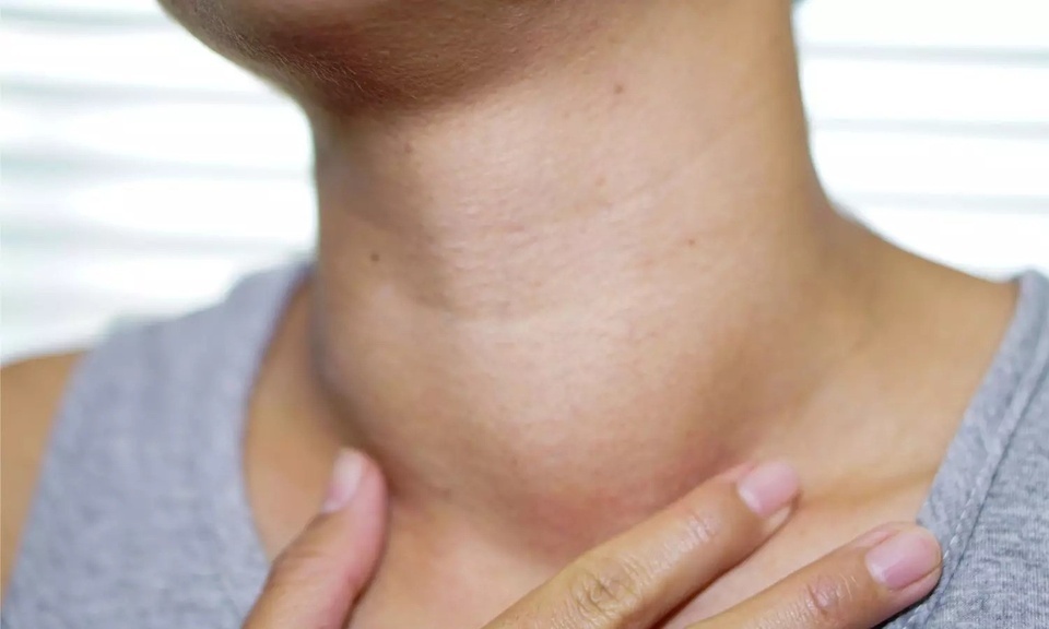 Ung thư tuyến giáp tăng nhanh: Đừng ngó lơ 'tín hiệu lạ' ở vùng cổ