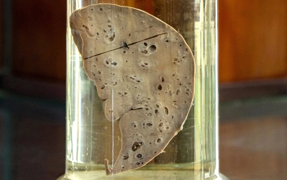 Một kiểu ăn uống có thể hủy hoại gan