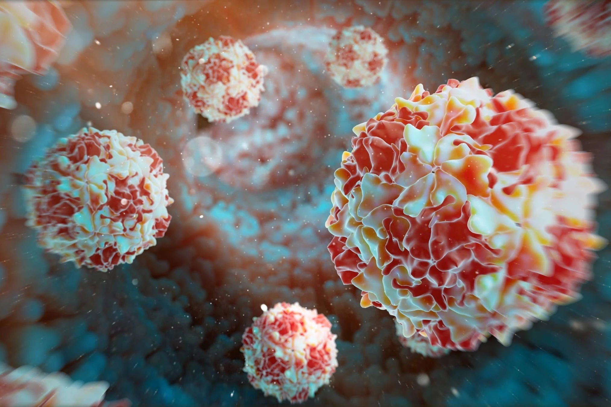 Australia phát hiện virus bại liệt trong nước thải sau hơn nửa thế kỷ