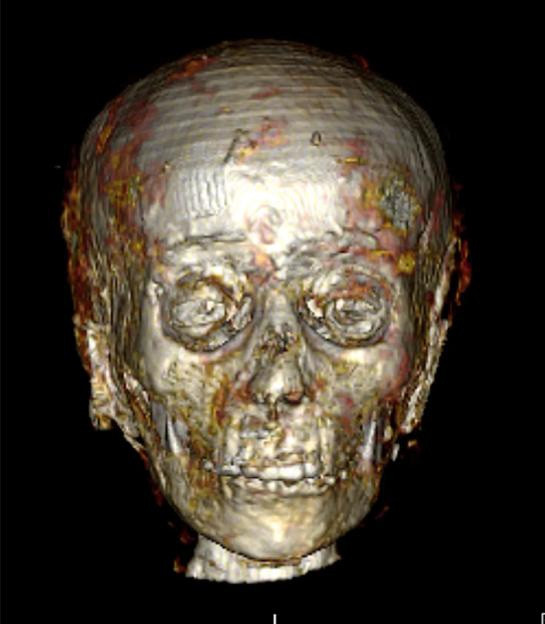 Giải mã xác ướp cậu bé vàng sau hơn 100 năm tìm thấy - Ảnh 2.